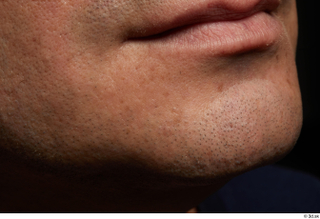 HD Face Skin Harrison Hill chin face lips mouth skin…